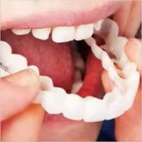 Carillas Dentales Instantáneas – Sonríe Perfecto en Minutos