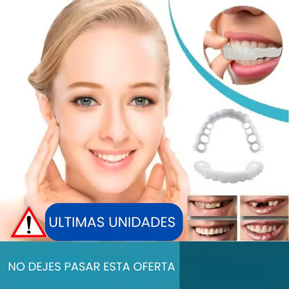 Carillas Dentales Instantáneas – Sonríe Perfecto en Minutos
