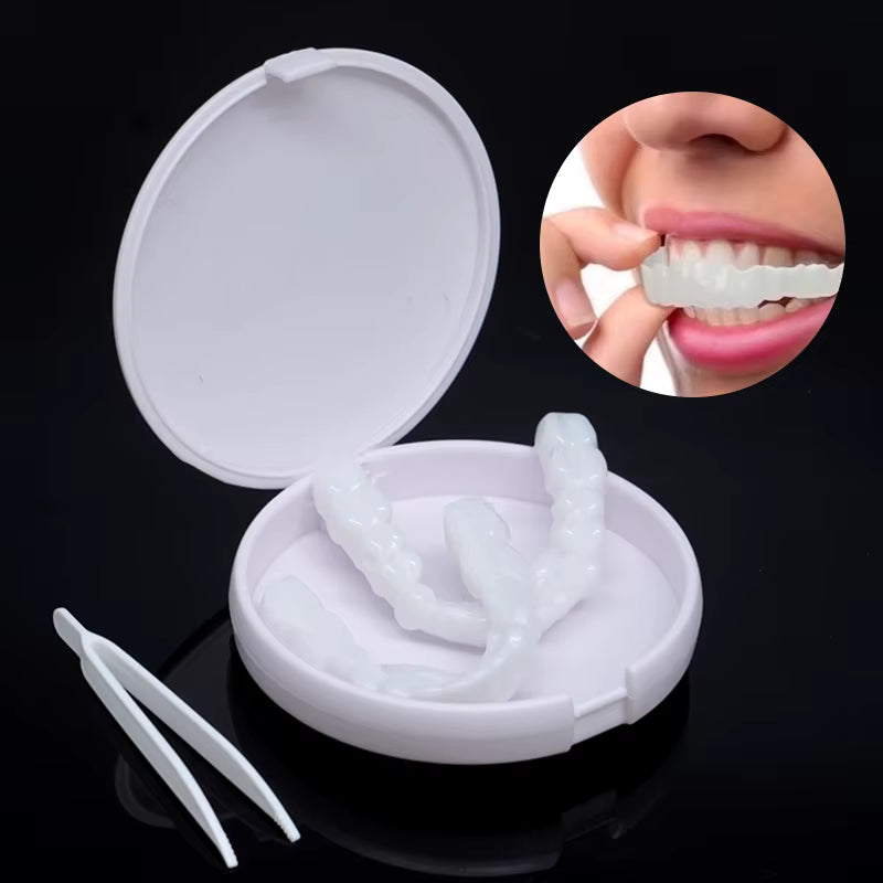 Carillas Dentales Instantáneas – Sonríe Perfecto en Minutos