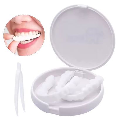 Carillas Dentales Instantáneas – Sonríe Perfecto en Minutos